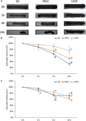 Contraction Dynamics of Rod Microtissues of Gingiva-Derived and Periodontal Ligament-Derived Cells